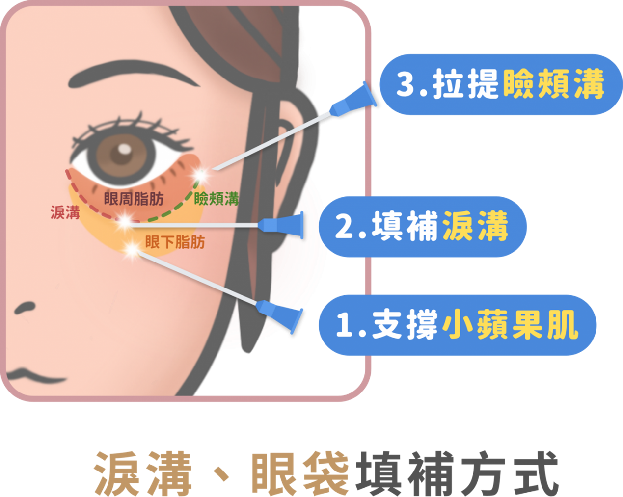 許惠翔醫師技術特色
