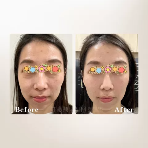 妍回美學診所