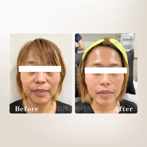 妍回美學診所