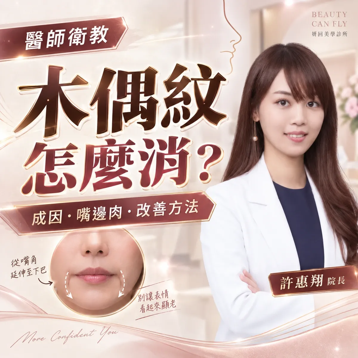 木偶紋怎麼消封面圖