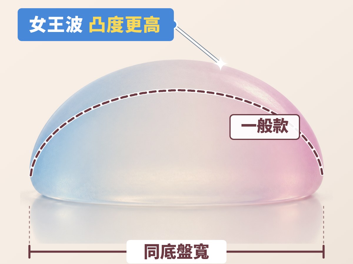 女王波與曼陀一般款同底盤寬的凸度比較：虛線為一般款輪廓，女王波凸度更高、上半部更飽滿｜妍回美學診所