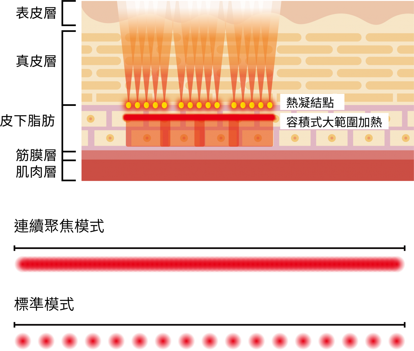 媚必提