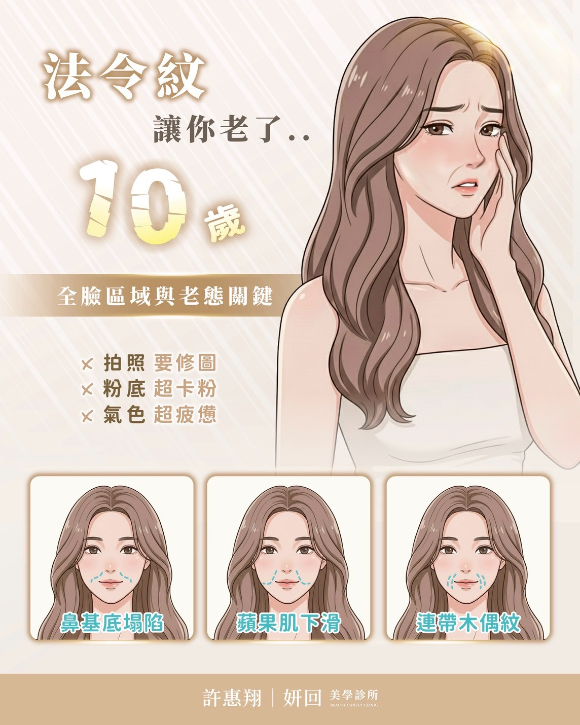 竹北妍回美學診所 台中許惠翔美學診所：法令紋成因分析海報。說明法令紋讓人顯老 10 歲，並標示「鼻基底塌陷、蘋果肌下滑、連帶木偶紋」為造成老態的三大關鍵。