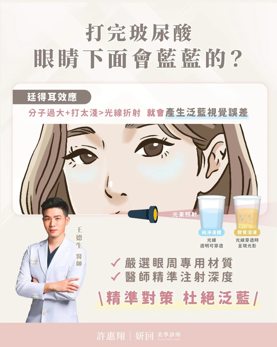 打完玻尿酸眼下會藍藍的？廷得耳效應原因解析｜王德生醫師｜妍回美學診所