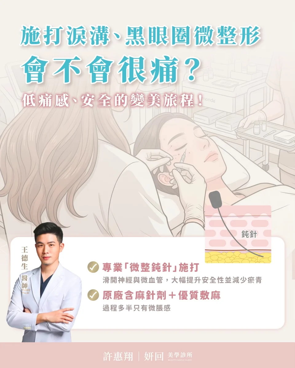施打淚溝、黑眼圈微整形會不會很痛？專業微整鈍針 + 原廠含麻針劑｜王德生醫師｜妍回美學診所