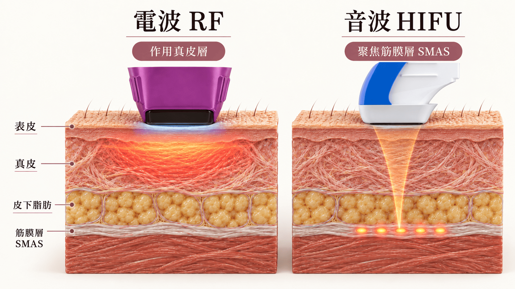 電波與音波作用層次比較示意圖