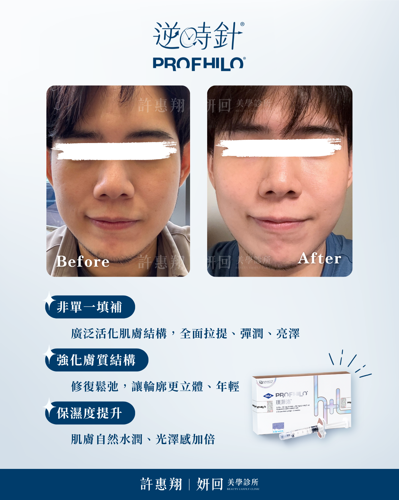 Profhilo 術前術後對比