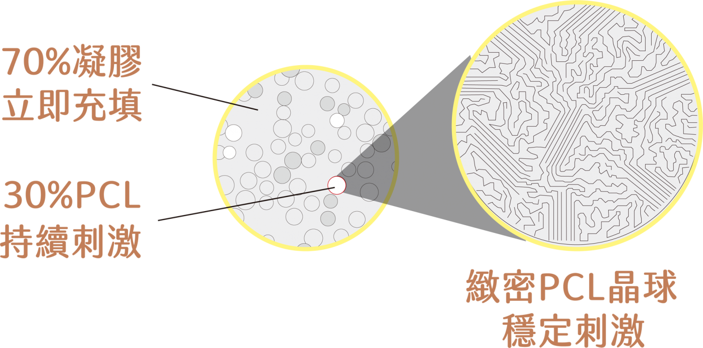 洢蓮絲 PCL 微晶球長效膠原蛋白增生示意圖