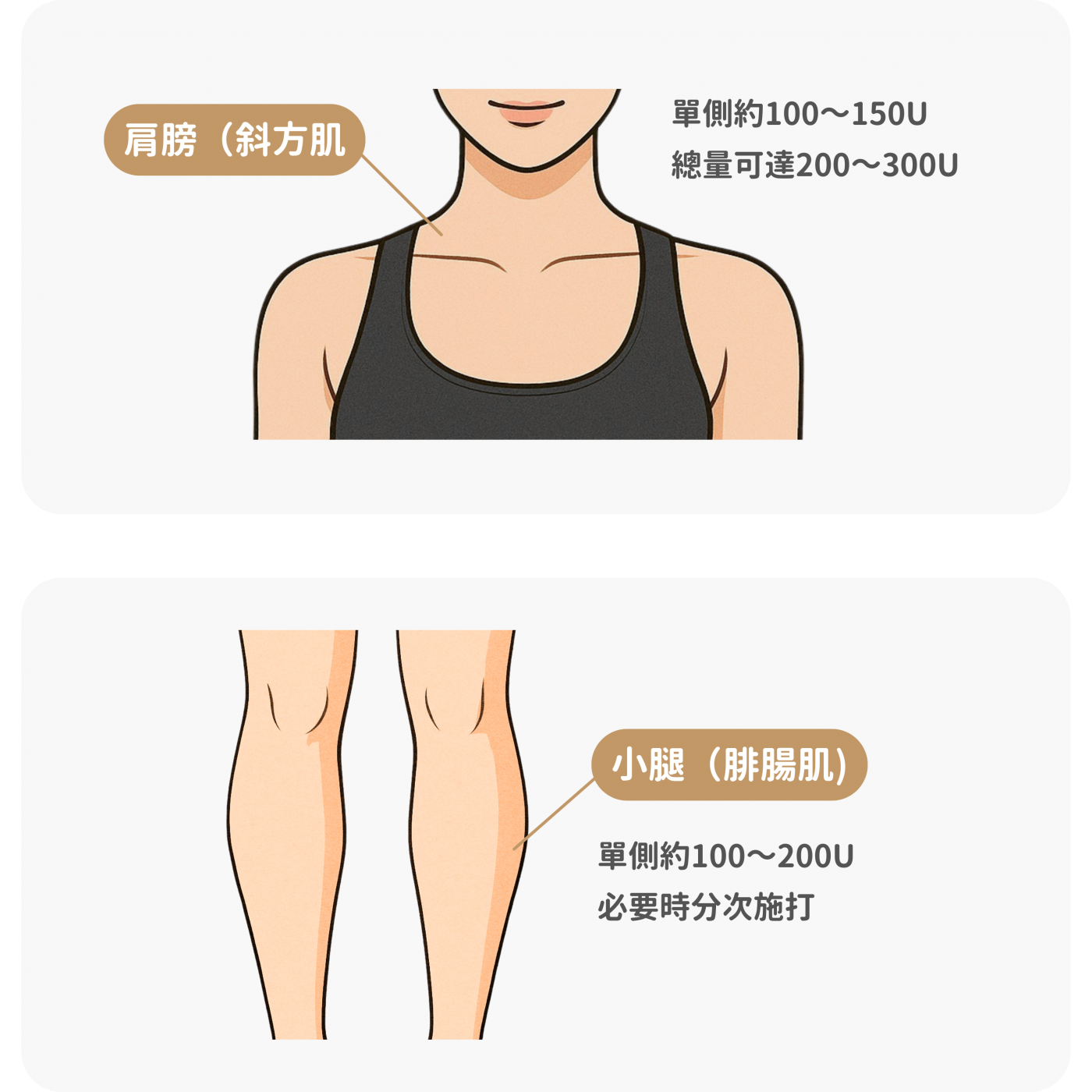 臉部各部位肉毒參考劑量圖-下半臉