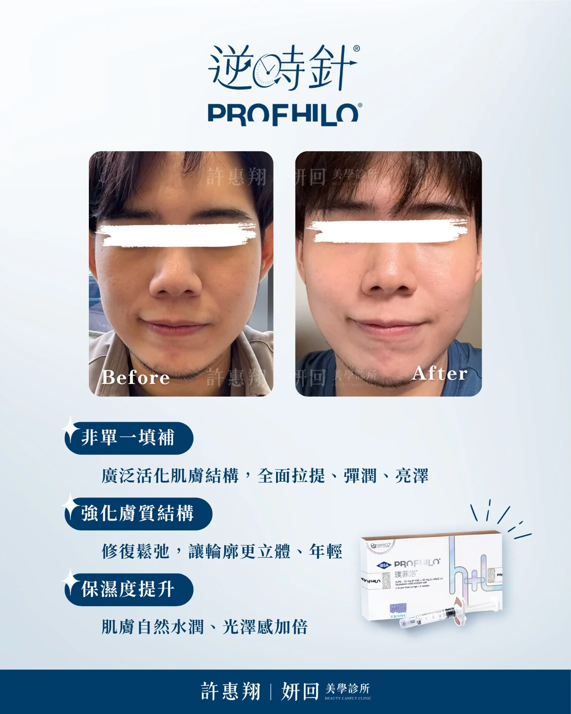 逆時針 Profhilo 真實案例：完成完整初始療程後的膚況與光澤對照｜妍回美學診所