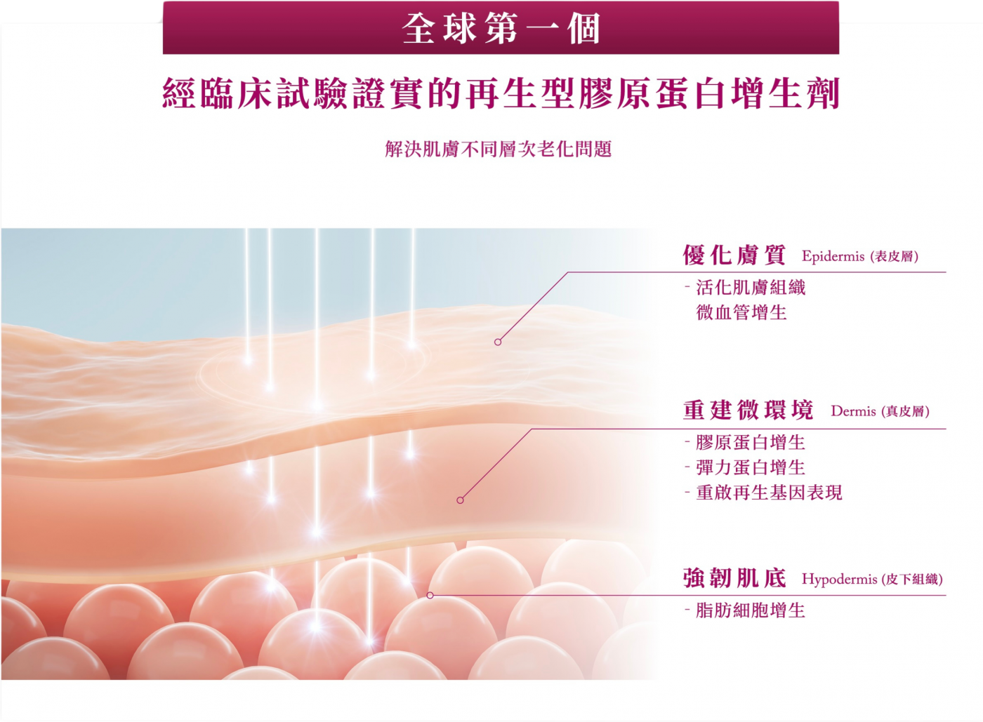 童顏針聚左旋乳酸作用的皮膚層次：表皮層優化膚質、真皮層膠原與彈力蛋白增生、皮下組織強韌肌底