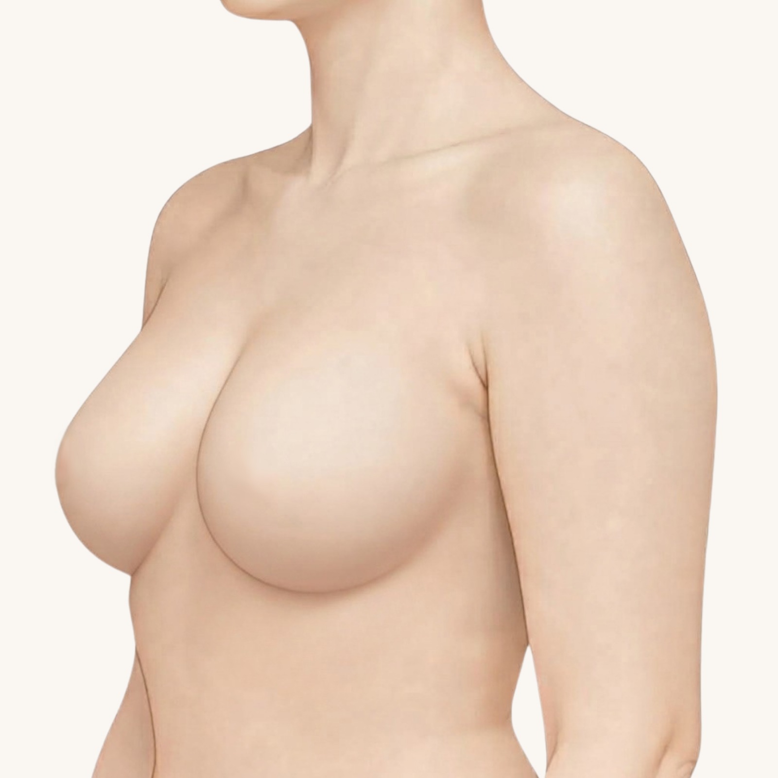 副乳手術重點插畫・斜側面術後：腋下前緣收平，乳房外側到手臂線條平順｜妍回美學診所