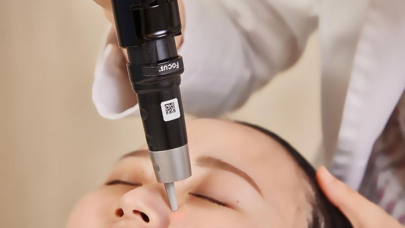 PicoSure 755 皮秒雷射治療中｜鉑金蜂巢透鏡手具｜妍回美學診所